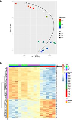 Pseudotemporal ordering of spatial lymphoid tissue microenvironment profiles trails Unclassified DLBCL at the periphery of the follicle